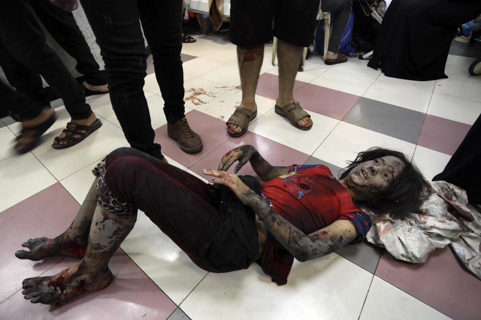 An injured Palestinian girls waits to receives treatment at the al-Shifa hospital, following Israeli airstrikes on Gaza City, central Gaza Strip, Sunday, Nov. 5, 2023. (AP Photo/Abed Khaled)