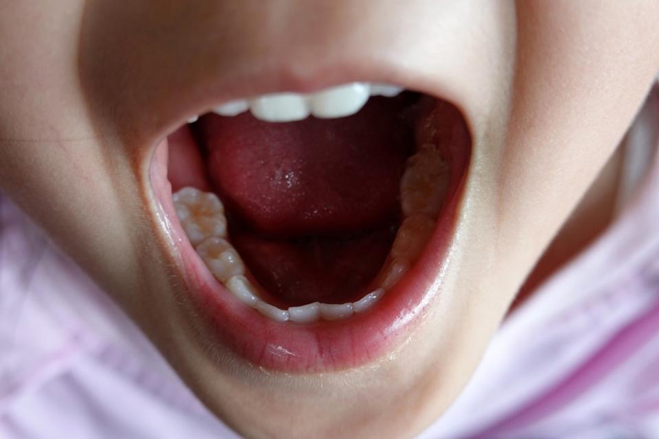 File photo: According to the NHS, babies’ bottom teeth are the first to arrive, usually at around five-to-seven months (Getty)