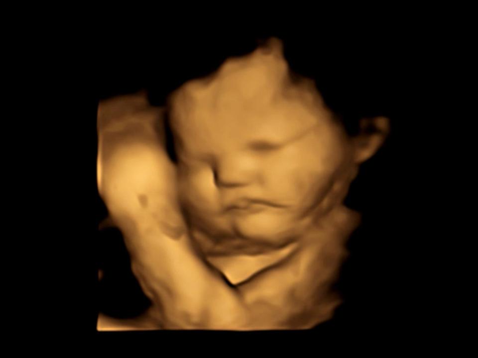 A 4D ultrasound image of a baby taken before flavours were introduced (Durham University / SWNS)