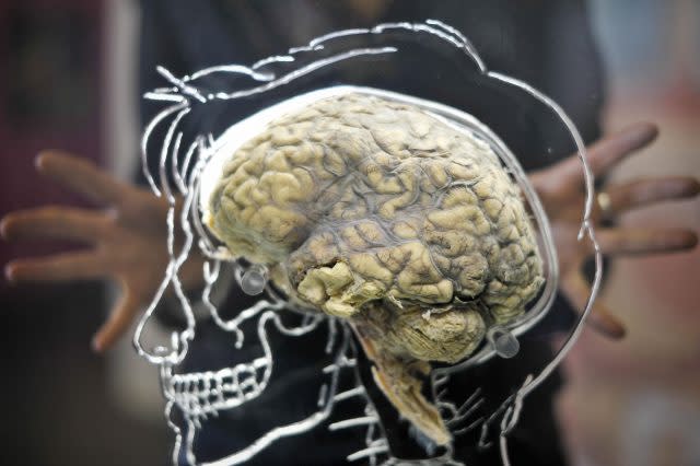 Scans showed reduced activity in some parts of the brain after taking the drug (Ben Birchall/PA