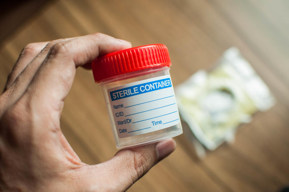 Personal point of view of a young person holding plastic urine collector and sterile bottle