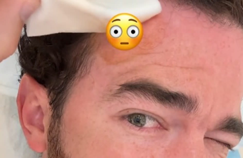 Kevin Jonas had skin cancer treatment (c) Instagram credit:Bang Showbiz