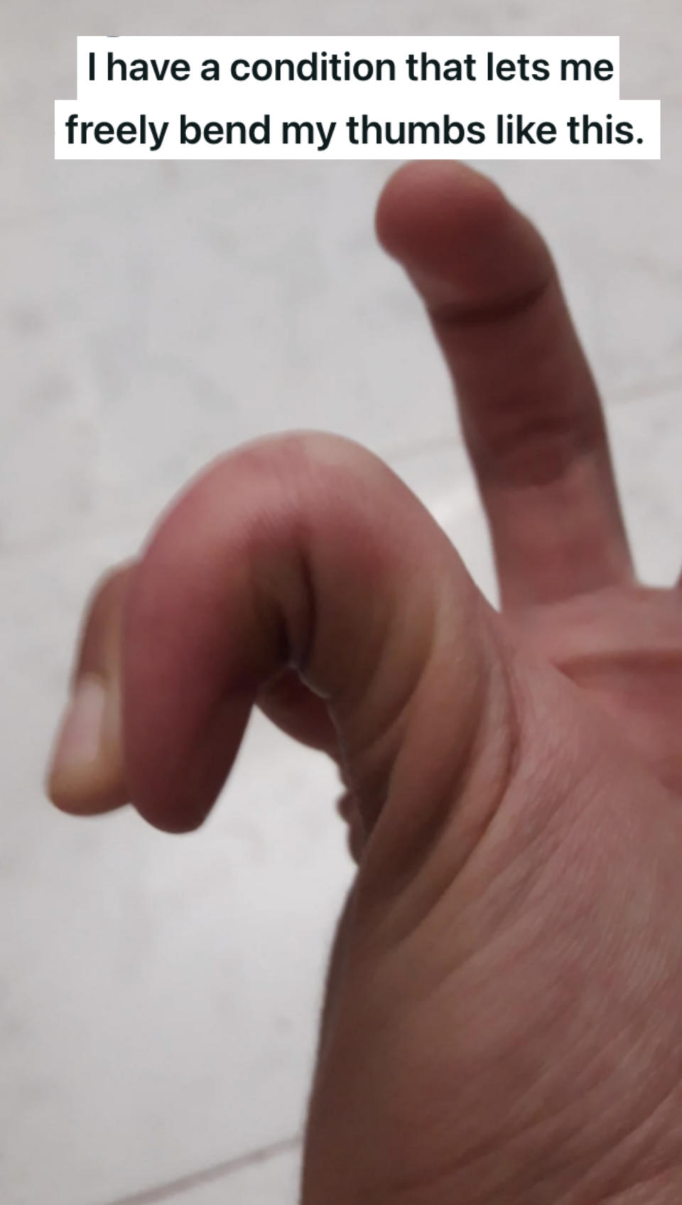 thumb is bending backwards