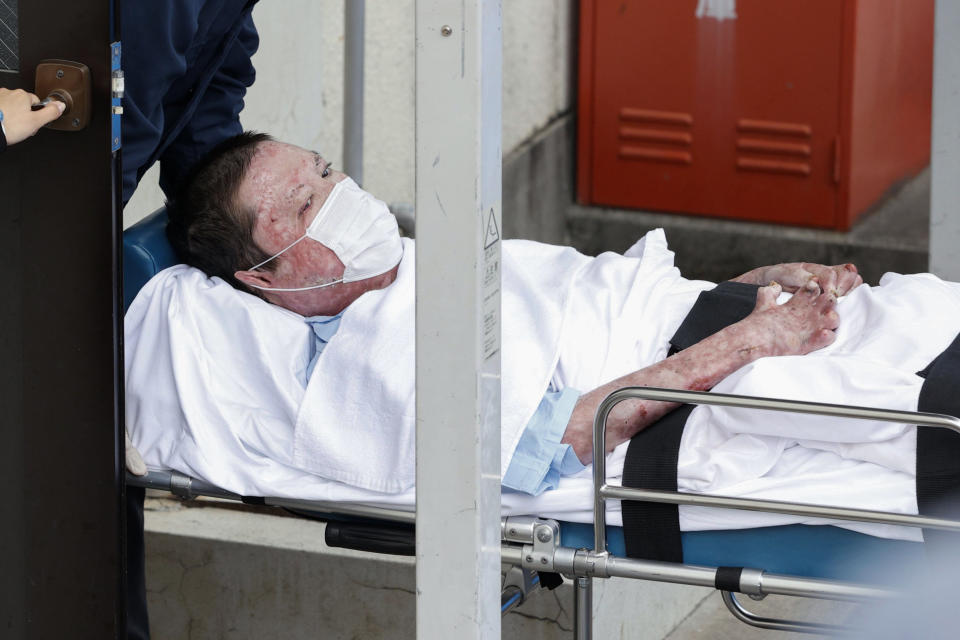 Shinji Aoba on a stretcher is carried to Fushimi police station after being arrested in Kyoto, western Japan, Wednesday, May 27, 2020. Japanese police arrested the suspect in a deadly arson at Kyoto Animation's No. 1 studio on July 18, 2019 after the alleged attacker regained enough strength from his own injury to respond to police investigation. Aoba is accused of storming into the studio, setting it on fire and killing 36 people. Wednesday's arrest comes 10 months after the police obtained permission from a local court as they had to wait for Aoba, who had suffered severe burns and was in a critical condition. (Suo Takekuma/Kyodo News via AP)