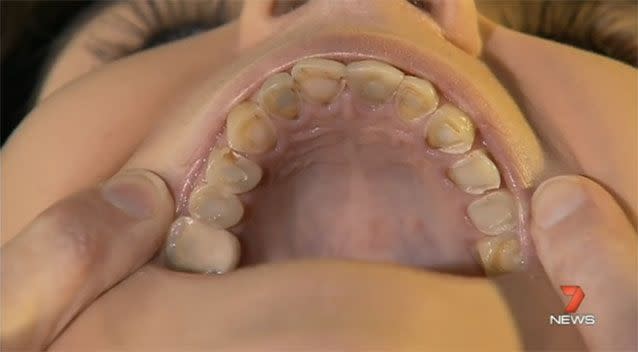 Matheson sat through nine root canals in her 'horror movie' experience. Source: 7News