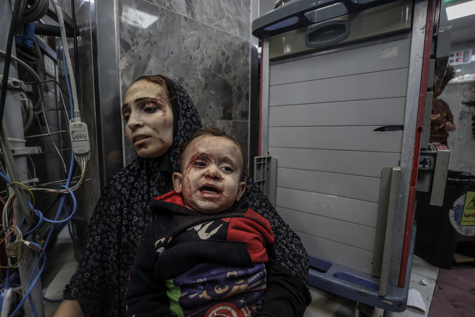 GAZA CITY, GAZA - OCTOBER 17: (EDITORS NOTE: Image depicts graphic content) Scores of injured people are being taken to Al-Shifa Hospital following Israeli airstrike on Al-Ahli Baptist Hospital in Gaza City, Gaza on October 17, 2023. Over 500 people were killed in an Israeli airstrike on Al-Ahli Baptist Hospital in Gaza on Tuesday, Health Ministry spokesman Ashraf al-Qudra told. (Photo by Ali Jadallah/Anadolu via Getty Images)