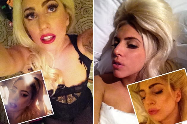 Lady Gaga: Hat sie sich Botox spritzen lassen?