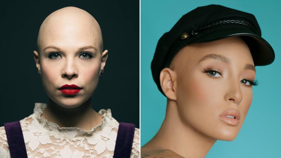 We spoke to size women about their experience with alopecia, and how their definition of beauty and self-confidence has changed.