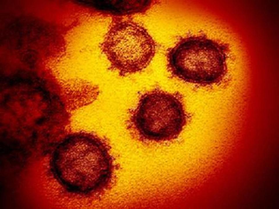 This transmission electron microscope image shows SARS-CoV-2, the virus that causes COVID-19, isolated from a patient in the U.S., emerging from the surface of cells cultured in the lab.