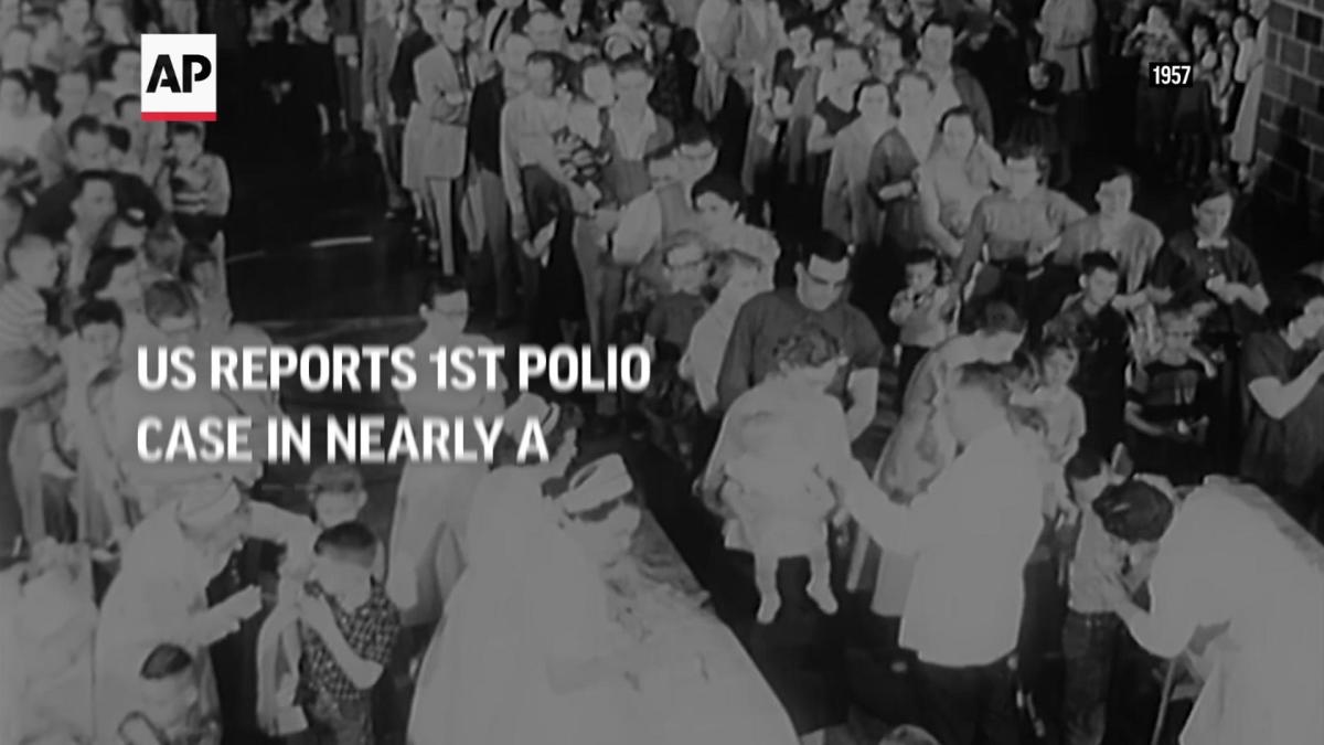 Us Reports 1st Polio Case In Nearly A Decade 5473