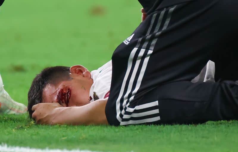 Hirving Lozano queda lesionado tras chocar con el portero Marvin Phillip durante partido de Copa Oro entre México y Trinidad y Tobago