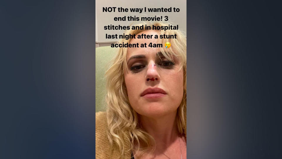Rebel Wilson shares photo after "stunt accident"