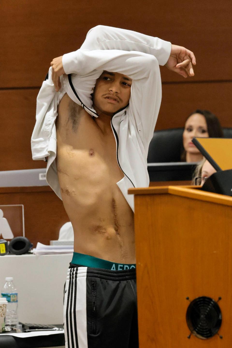 Former Marjory Stoneman Douglas High School student Anthony Borges shows his gunshot wounds to the jury. He was shot five times. Marjory Stoneman Douglas High School shooter Nikolas Cruz is being tried in the penalty phase of his trial at the Broward County Courthouse in Fort Lauderdale on Wednesday, July 20, 2022. Cruz previously plead guilty to all 17 counts of premeditated murder and 17 counts of attempted murder in the 2018 shootings. 