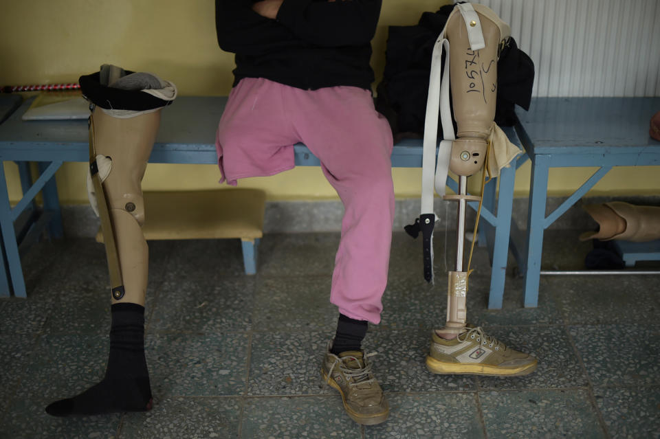 <p>An Afghan amputee man waits at one of the International Committee of the Red Cross (ICRC) hospitals for war victims and the disabled in Kabul on April 3, 2016.<br> The ICRC orthopaedic project was set up in 1988 in Kabul. (Photo: Shah Marai/AFP/Getty Images) </p>