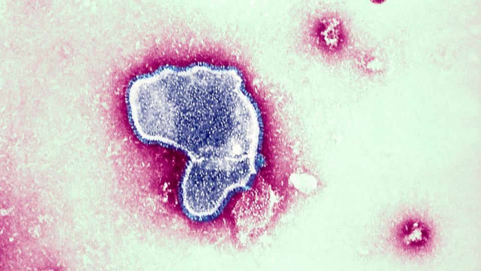 PHOTO: An electron micrograph shows the morphologic traits of the Respiratory Syncytial Virus Rsv. (BSIP/UIG Via Getty Images, FILE)