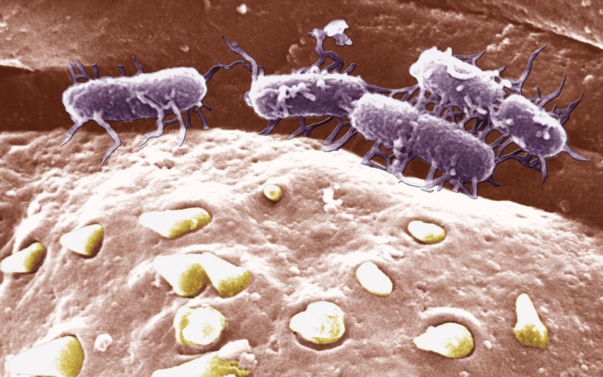 Two new highly drug-resistant strains of Salmonella Typhi, responsible for typhoid fever, have been found in Bangladesh - Universal Images Group Editorial