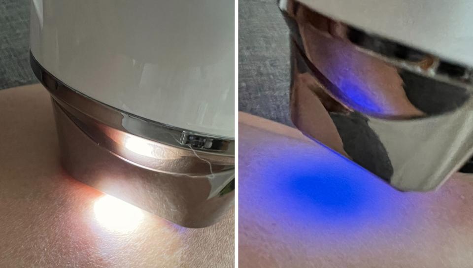 The device will light up with a white light to indicate safe for use. Then it will emit blue to pink/red light to indicate the removal process. (PHOTO: Reta Lee/Yahoo Life Singapore)