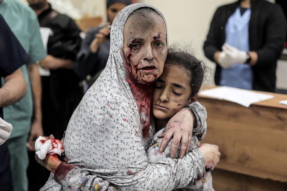 An injured Palestinian woman covered in dust and blood hugs an injured girl child at a hospital following an Israeli bombardment of Khan Yunis in the southern Gaza Strip on Nov. 15, 2023.