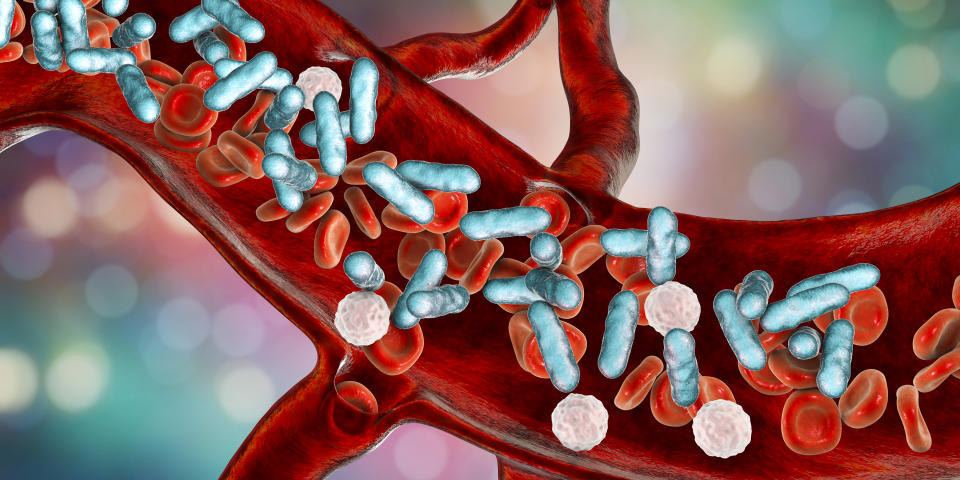 Bacterial blood infection, computer illustration.