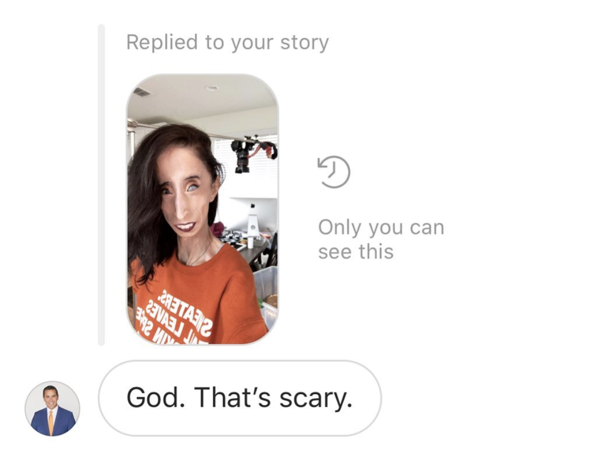 Lizzie Velasquez re-posts reporter's rude comment to her feed to shed light on cyberbullying. (Photo: Instagram)