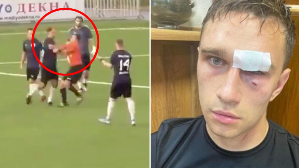 Pictured here, a shot of the shocking attack that left referee Nikita Danchenko in hospital.