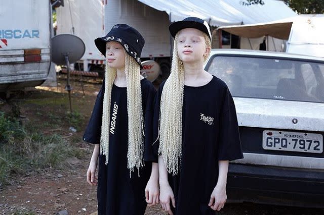 Albino twins Lara and Mara Bawar are getting attention in the modeling industry. (Photo: Lara Mara Sheila/Instagram)