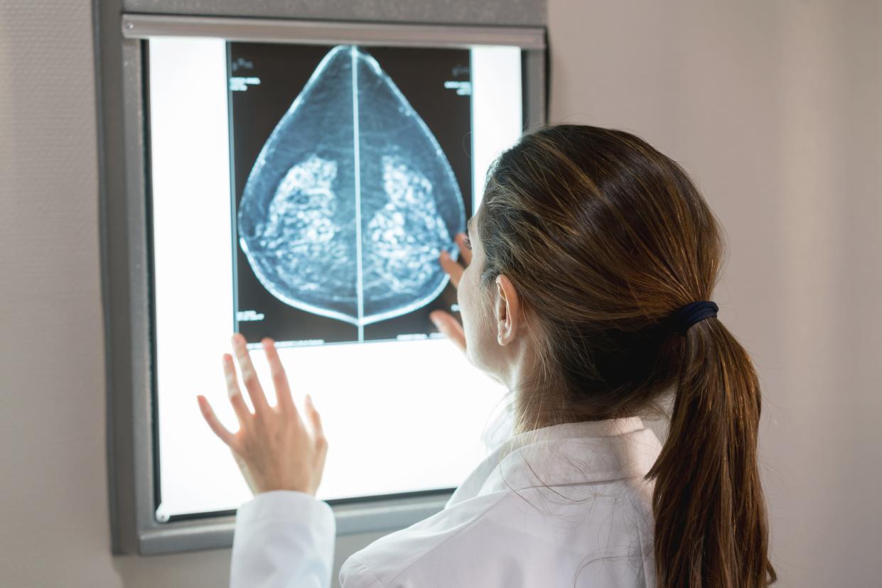 A doctor looking at a mammogram