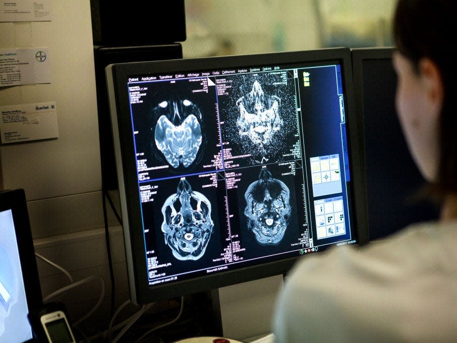 A technician looks at a computer screen showing a brain scan.