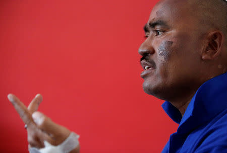 Indian climber Nava Kumar Phukon, who says he successfully climbed Mount Everest, speaks with the media with a bruise on his face, at a hotel in Kathmandu, Nepal, May 24, 2016. REUTERS/Navesh Chitrakar