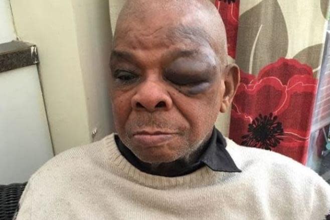 Albert Wright, 88, was brutally mugged in the street: Go Fund Me