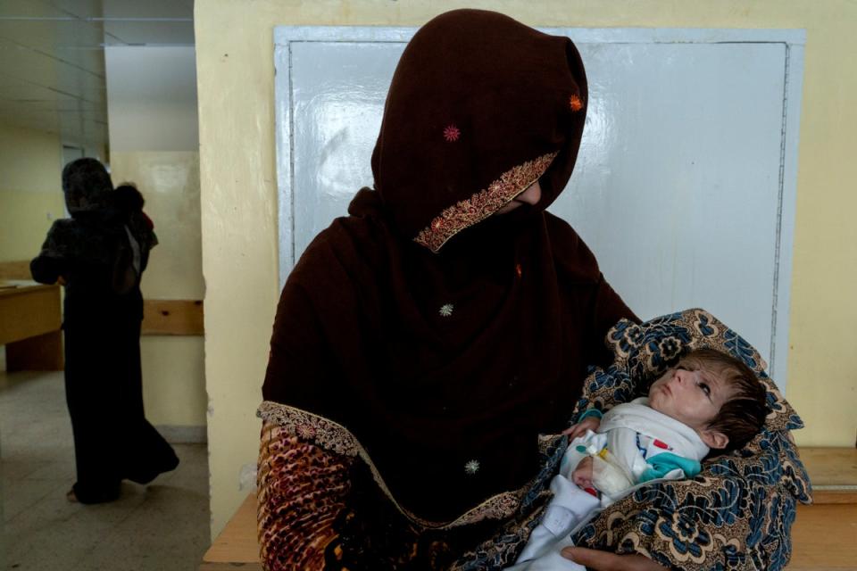 A mother holds her malnourished baby at the malnutrition ward of the Indira Gandhi hospital in Kabul, Afghanistan (Associated Press)