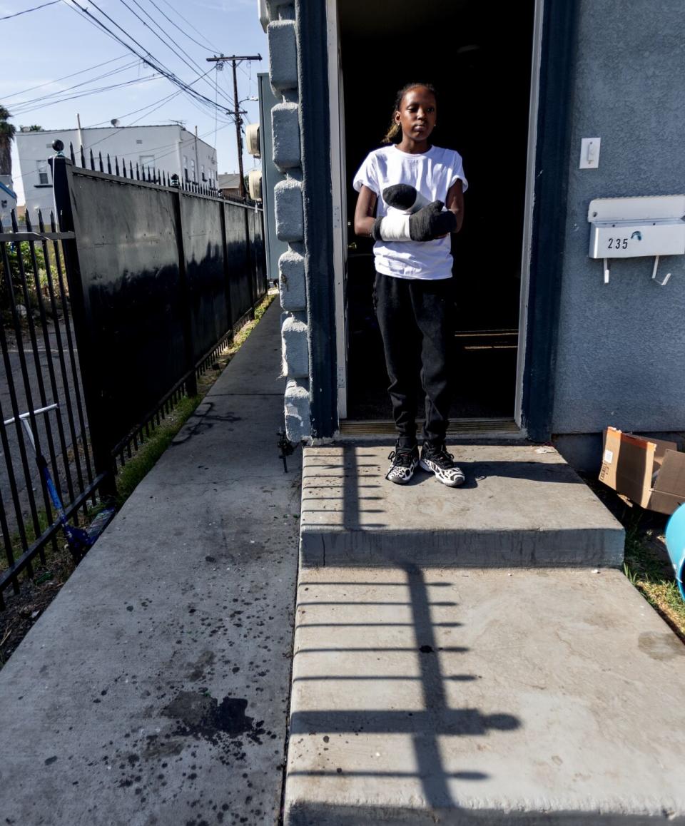 A girl with both arms in casts stands in a doorway