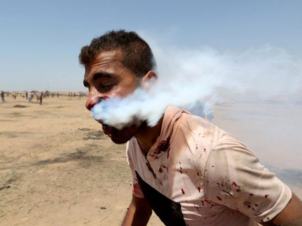 A wounded Palestinian demonstrator, Haitham Abu Sabla, 23, is hit in the face with a tear gas canister fired by Israeli troops: Reuters