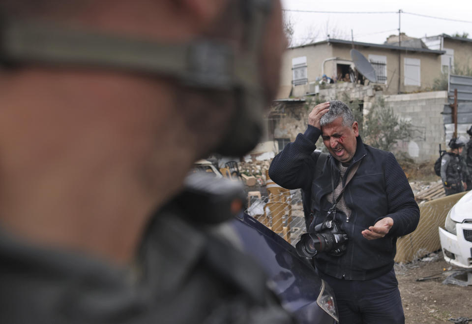 Associated Press photographer Mahmoud Illean reacts after being attacked by Israeli police while covering a demonstration in the east Jerusalem neighborhood of Sheikh Jarrah, Friday, Dec. 17, 2021. Illean had been covering a weekly demonstration where longtime Palestinian residents are battling efforts by Jewish settlers to evict them from their homes. He did not suffer any fractures and returned home from the hospital several hours later with a bruised face and head and back pain. (Ahmad Gharabli/AFP via AP)