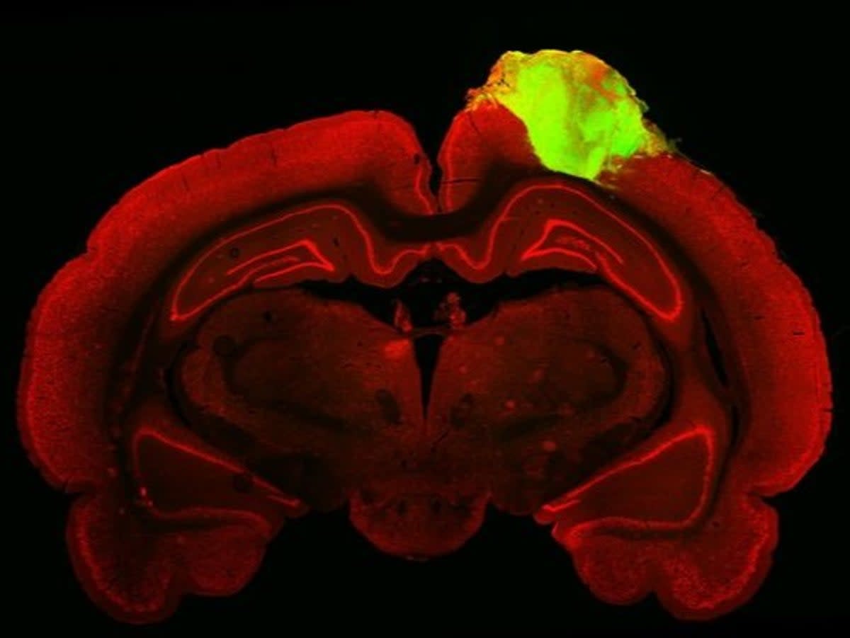 A rat brain with a transplanted human cortical organoid (green) (Jgamadze et al., Cell Stem Cell)