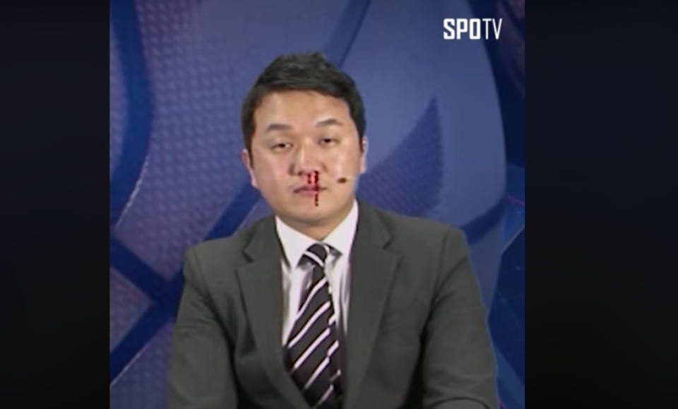韓國體育主播播報時流鼻血。（取自SPOTV)