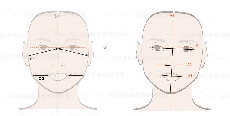 可依圖判斷自己是否臉型不對稱。