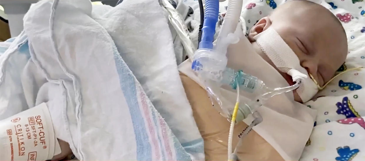 Cory Robertson's 7-week-old son needed a ventilator due to his RSV infection. (courtesy Cory Robertson)