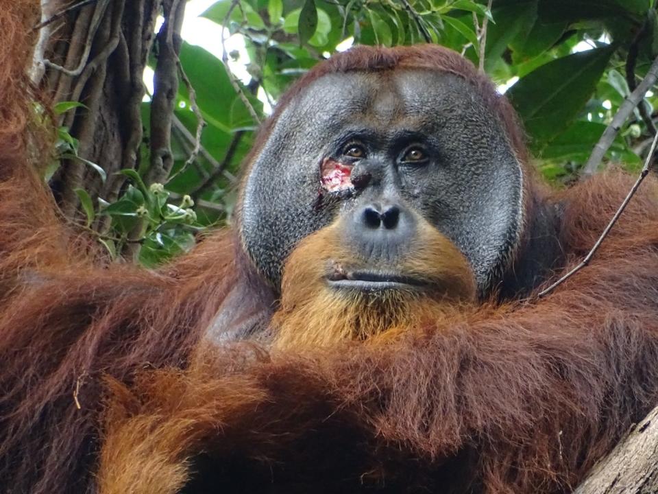 Un orangután salvaje de Sumatra llamado Rakus dos meses después de que los científicos le observaran aplicándose repetidamente una planta medicinal masticada para tratar una herida facial, en el Parque Nacional de Gunung Leuser en Sumatra, Indonesia, en junio de 2022. (Safruddin vía The New York Times)