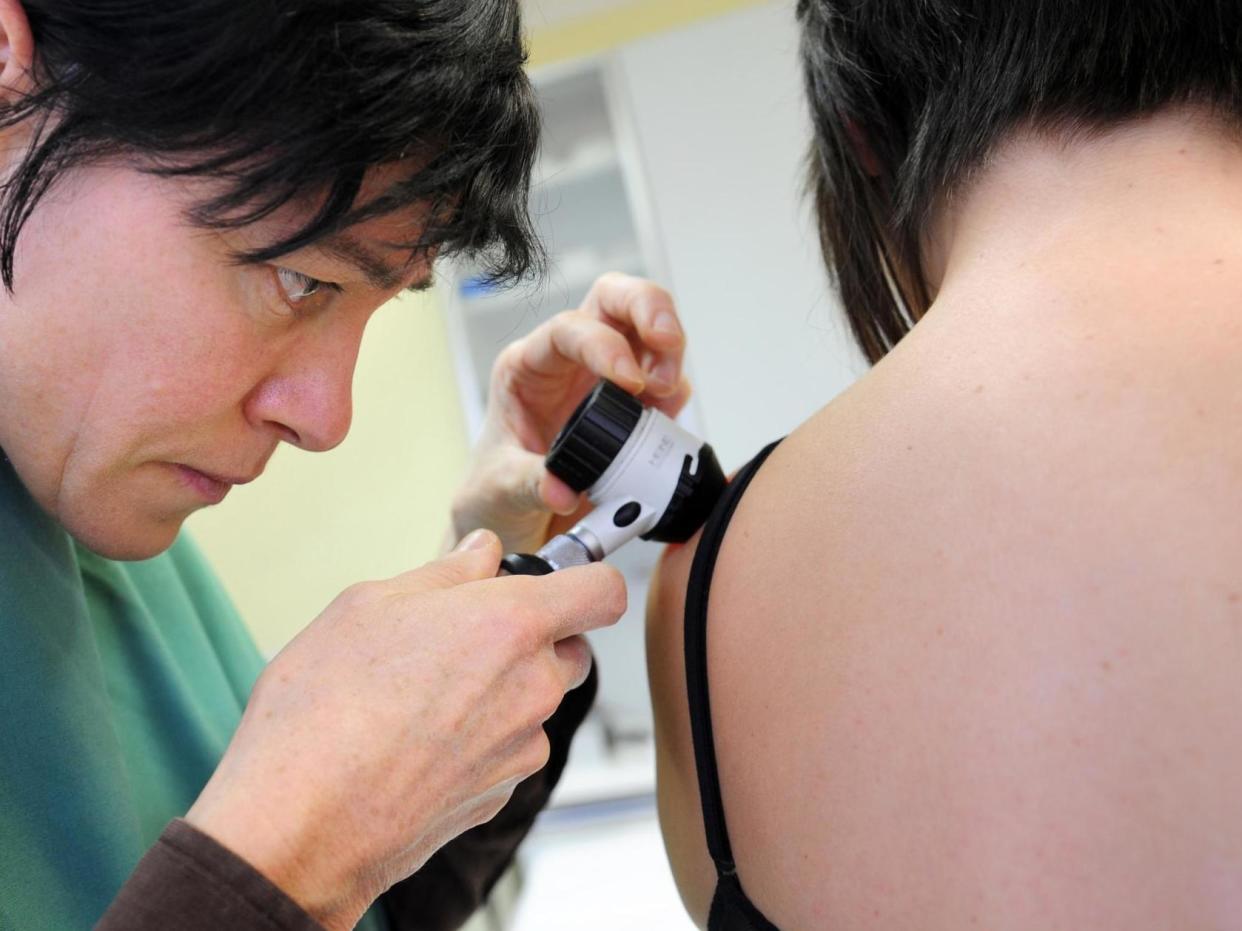Dermatologists have found a number of skin conditions linked to coronavirus: Getty
