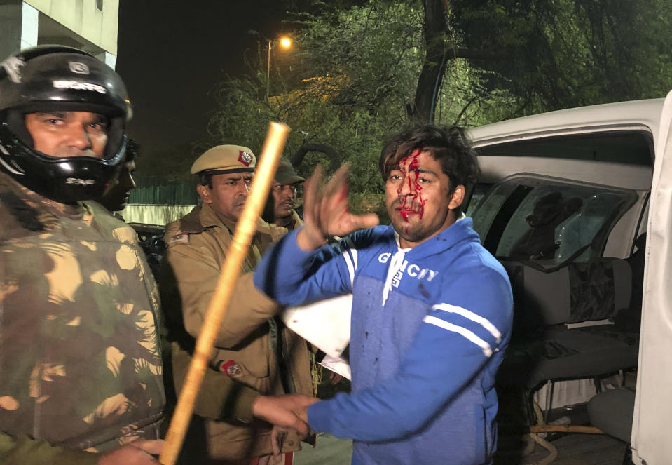 Policemen detain an injured student outside Jamia Millia Islamia university during a protest against Citizenship Amendment Act in New Delhi, India, Sunday, Dec. 15, 2019. Protests have been continuing over a new law that grants Indian citizenship based on religion and excludes Muslims. (AP Photo/Saaliq Sheikh)