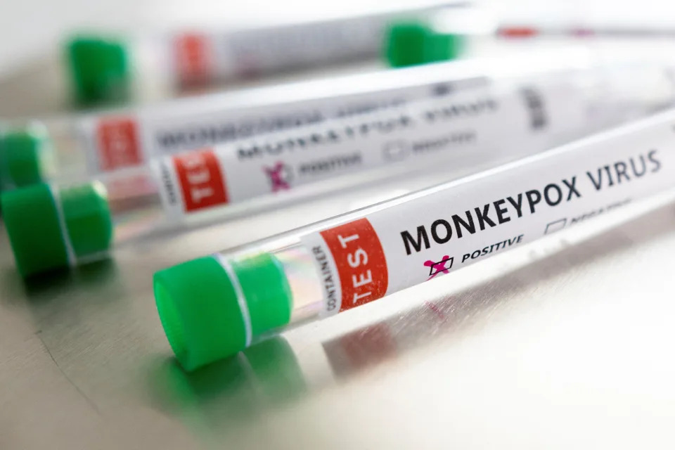 猴痘英文名為monkeypox。示意圖來源：Getty Images