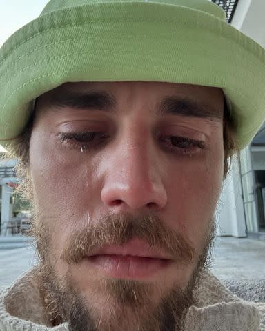 <p>Justin Bieber/Instagram</p> Justin Bieber shares photo of himself crying.