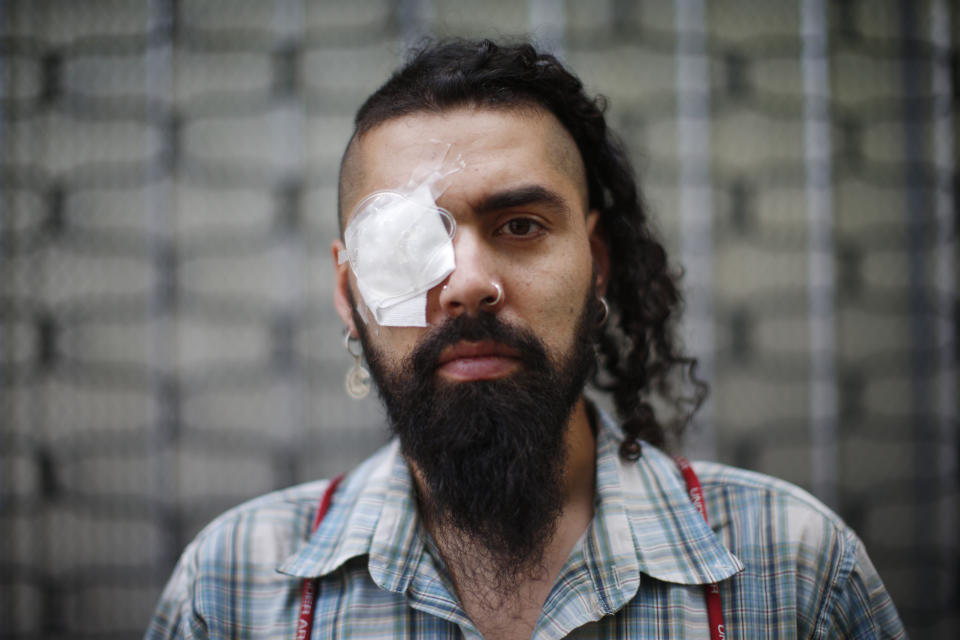 Marcelo Herrera, who claims he he received eye injuries after being shot with a shotgun by the police during the ongoing anti-government demonstrations, poses for a portrait during a protest in front of Palacio de La Moneda, in Santiago, Chile, Friday, Dec. 13, 2019. The United Nations released on Friday a report which stated that there have been serious violations of human rights during the repression of recent protests in Chile. (AP Photo/Luis Hidalgo)