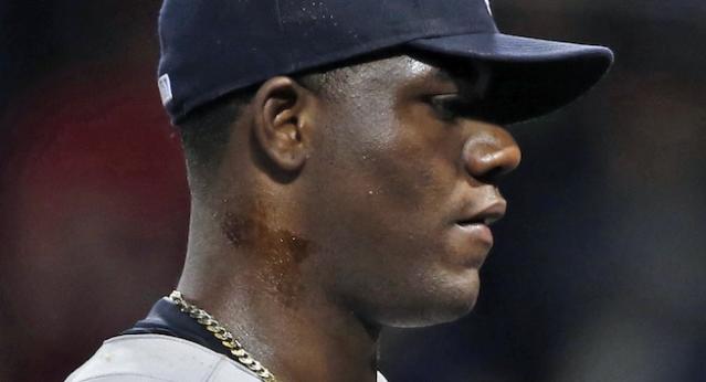 Why It Is Still a Big Deal That Pitchers Use Pine Tar