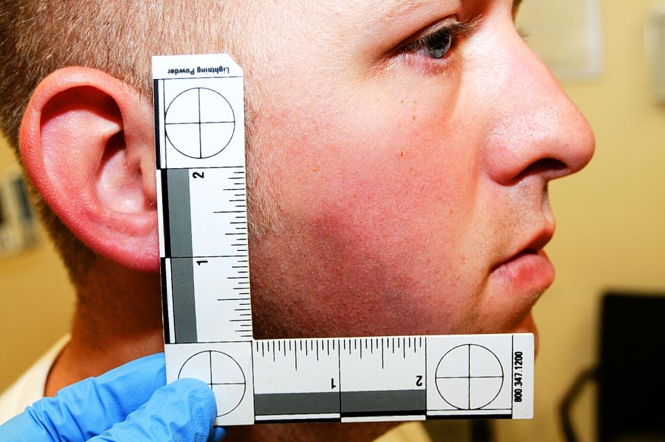 Fotografía de Darren Wilson mientras era examinado por un médico tras el trágico hecho. (AP Photo/St. Louis County Prosecuting Attorney&#39;s Office) 