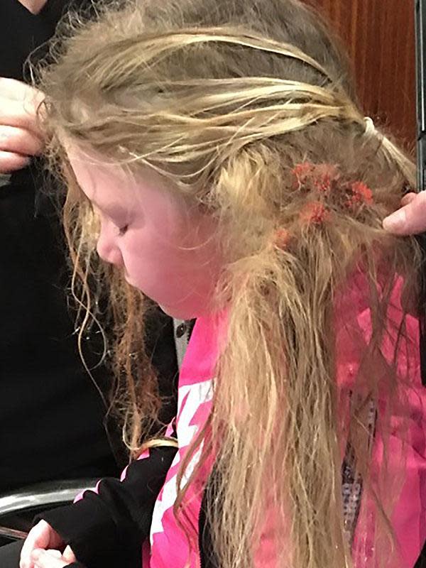 Wild pic shows how girl, 6, got 150 Bunchems toys caught in her hair – and  mom had to spend 20 hours getting them out