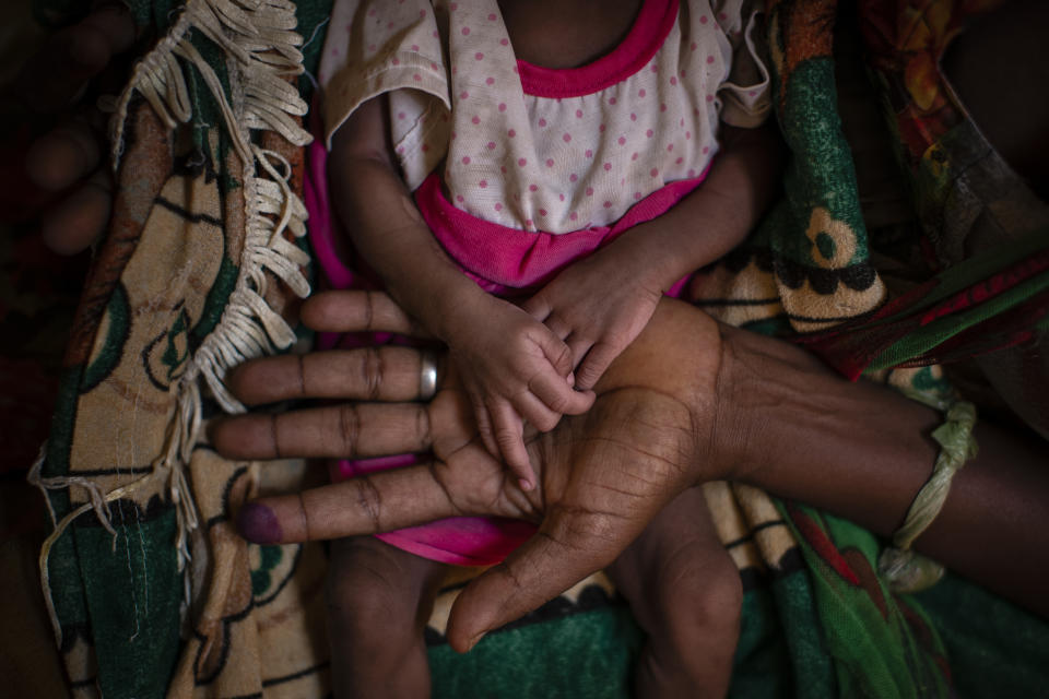FILE - In this Tuesday, May 11, 2021 file photo, Abeba Gebru, 37, from the village of Getskimilesley, holds the hands of her malnourished daughter, Tigsti Mahderekal, 20 days old, in the treatment tent of a medical clinic in the town of Abi Adi, in the Tigray region of northern Ethiopia. In an interview with The Associated Press Tuesday, Sept 28, 2021, the United Nations humanitarian chief Martin Griffiths calls the crisis in Ethiopia a "stain on our conscience" as children and others starve to death in the Tigray region under what the U.N. calls a de facto government blockade of food, medical supplies and fuel. (AP Photo/Ben Curtis, File)