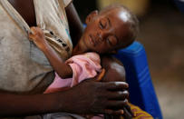 A severely acute malnourished and internally displaced Congolese child holds on to her mother as she waits to receive medical attention at the Tshiamala general referral hospital of Mwene Ditu in Kasai Oriental Province in the Democratic Republic of Congo, March 15, 2018. Picture taken March 15, 2018. REUTERS/Thomas Mukoya