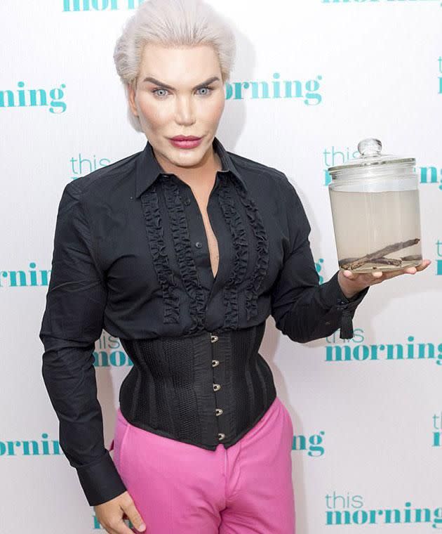 Human Ken Doll Rodrigo carries his ribs in a jar. Photo: REX